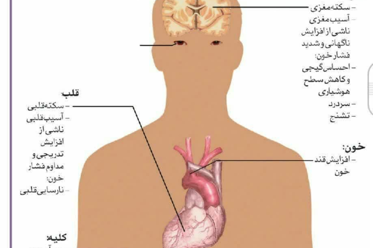 مهمترین عوارض فشار خون بالا فشار خون را شوخی نگیرید!